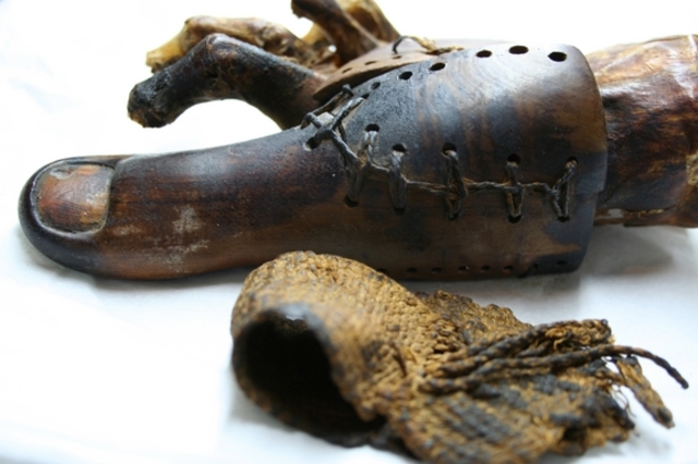 Earliest example of a Prosthetic