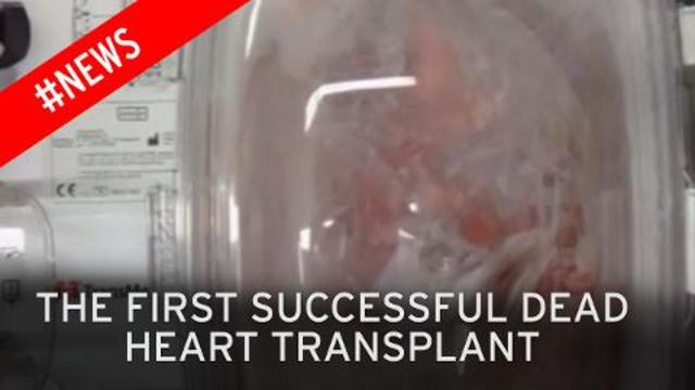 Europe's first non-beating heart transplant