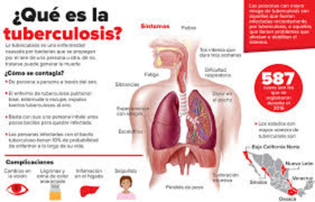Tuberculosis