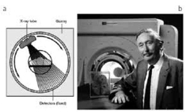 Tomografía computada - Godfrey Newbold Hounsfield