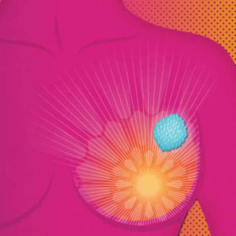 Oncology and molecular vaccines