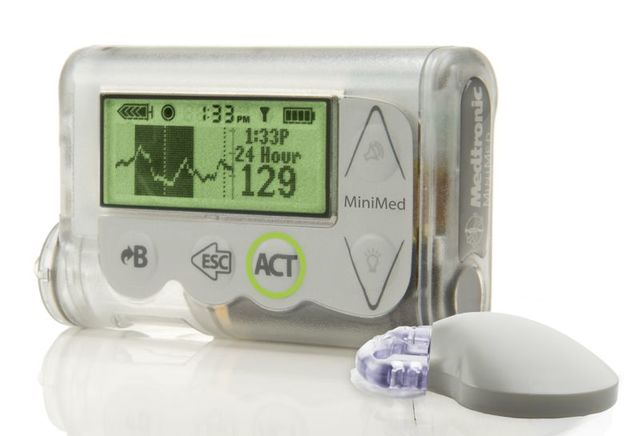 Artificial Pancreas: Trials