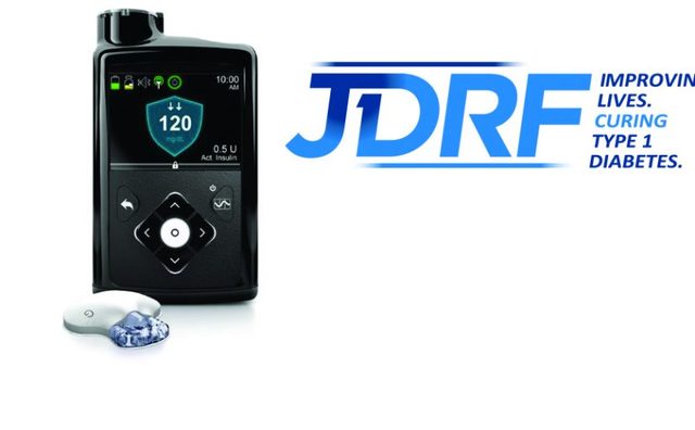 Invention of the First Artificial Pancreas System