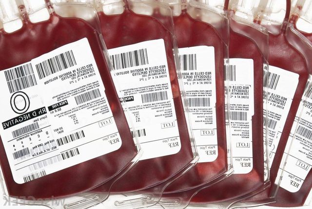 Transfusión de sangre