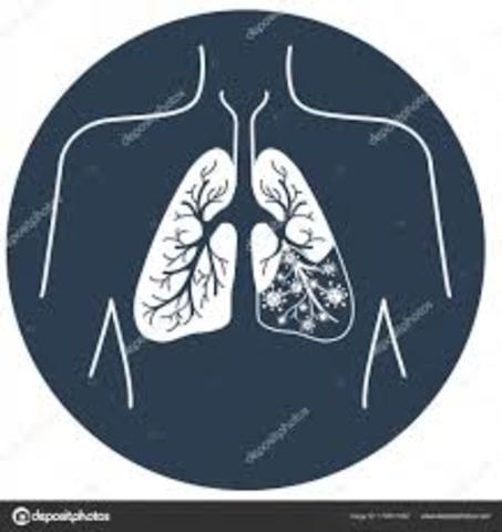 se demuestra la incidencia en las personas de contraer carcinoma