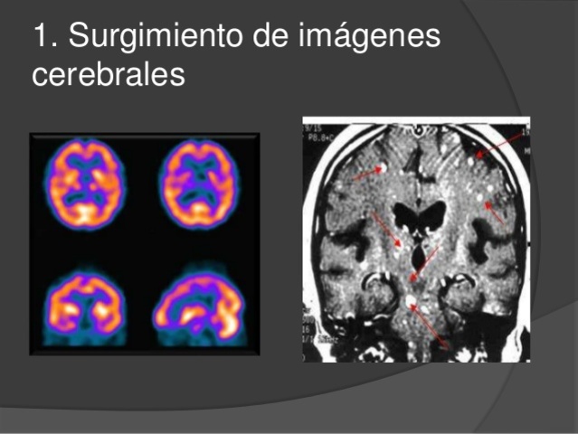 Crecimiento notorio de la Neuropsicología