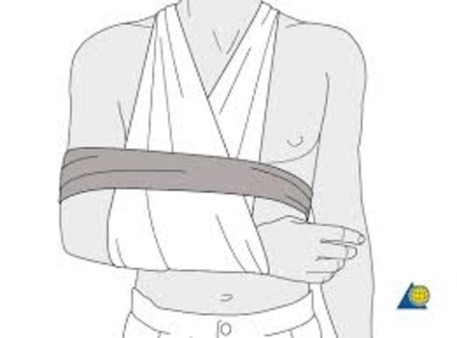 Broke My shoulder( Scared)