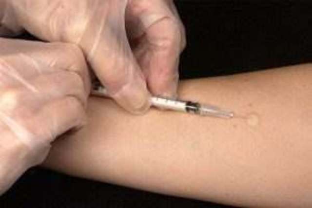 Publica remedio contra la tuberculosis