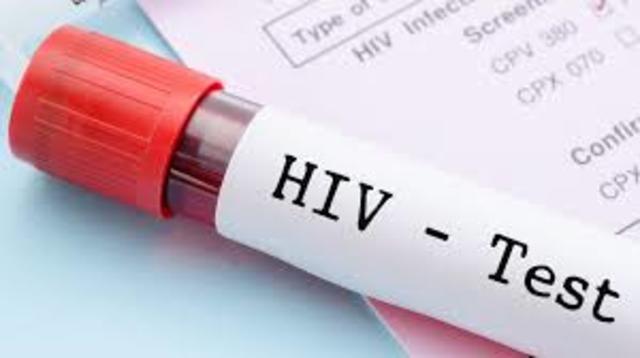 Aparecen primeros casos de sida