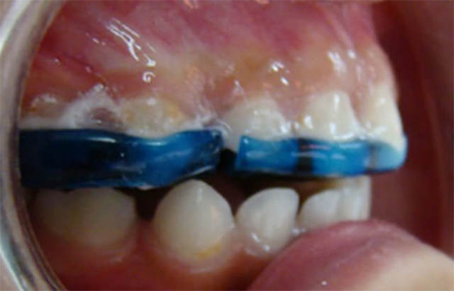 Piones Europeos a principios del siglo XIX