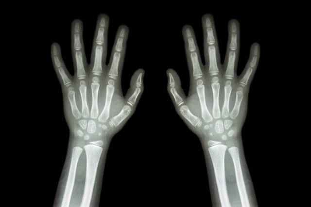 Primera Radiografía En Colombia.