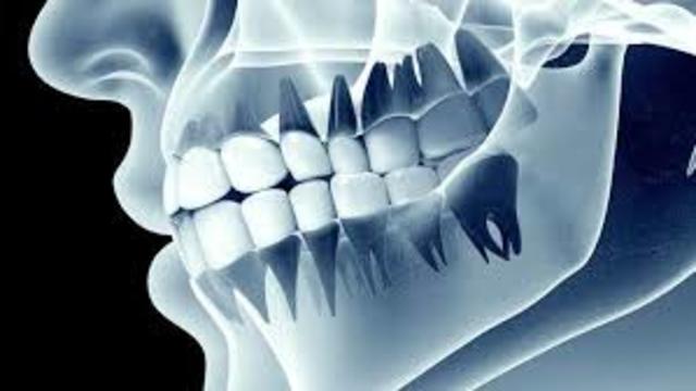 Primer Consultorio Radiológico En Medellín