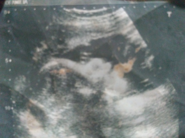 nacimiento de mi hermano menor