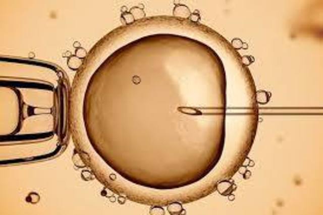 CLONACIÓN DEL VIRUS HIV