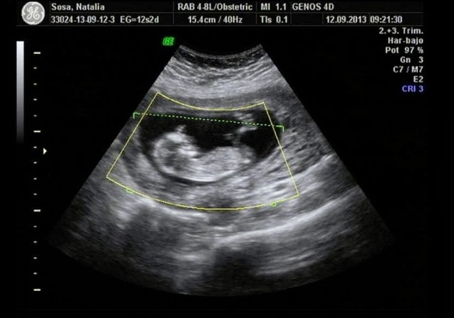 Me entere que iba a hacer tía por 3 vez