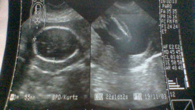 Mi primera fotografia