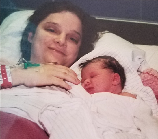 Cesarean Delivery - Biological