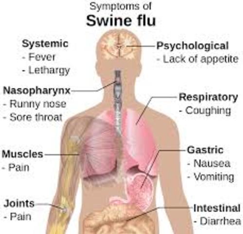 The Swine Flu