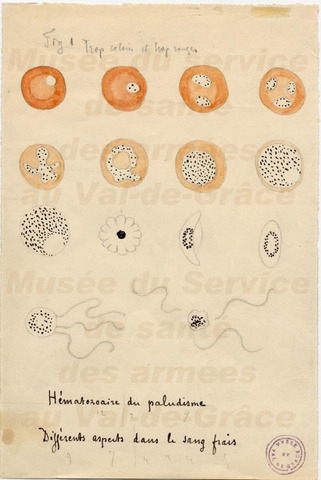 Discovery of the plasmodium falciparum