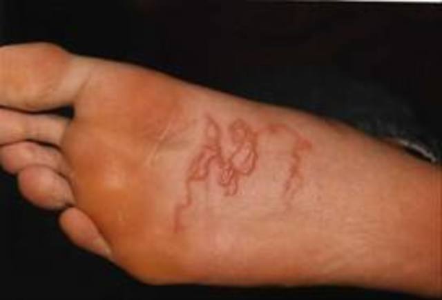 Historia de la Parasitología