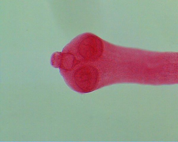 Helmintos en la Historia