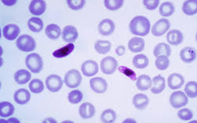 Plasmodium falciparum is described as the causative agent of malaria