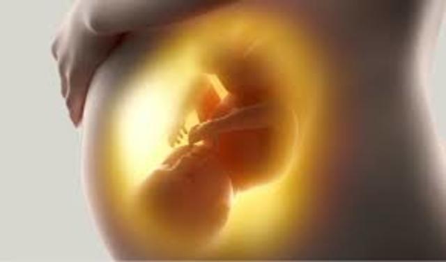 Primer caso de SIDA perinatal