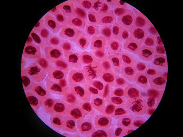 Visualización de cromosomas en división con técnicas de tinción