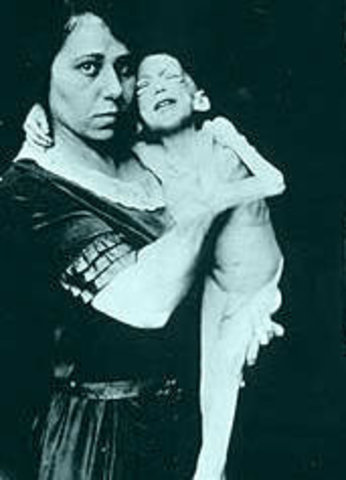 Severe Calorie Restriction