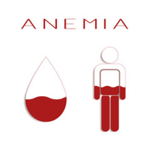Anemia Hemolítica inmune.