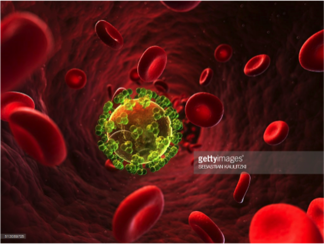 AIDS Comes to the U.S.