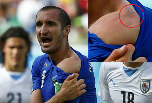 Reacción controversial de Suarez