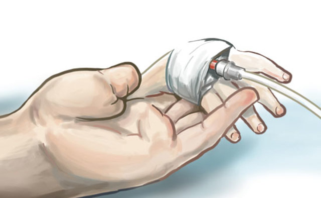 Eutanasia autonomizada.