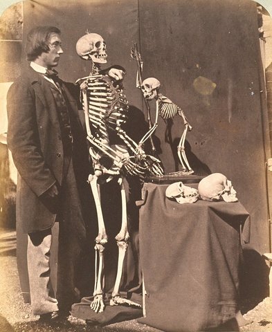 Reginald Southey and Skeletons