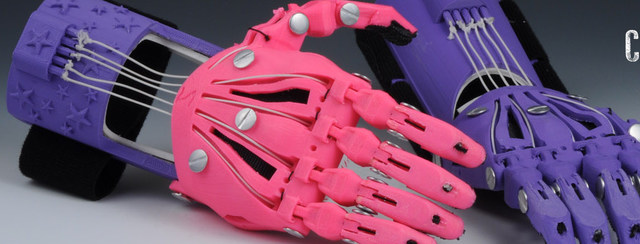 AVANCE DE LA PROTESIS