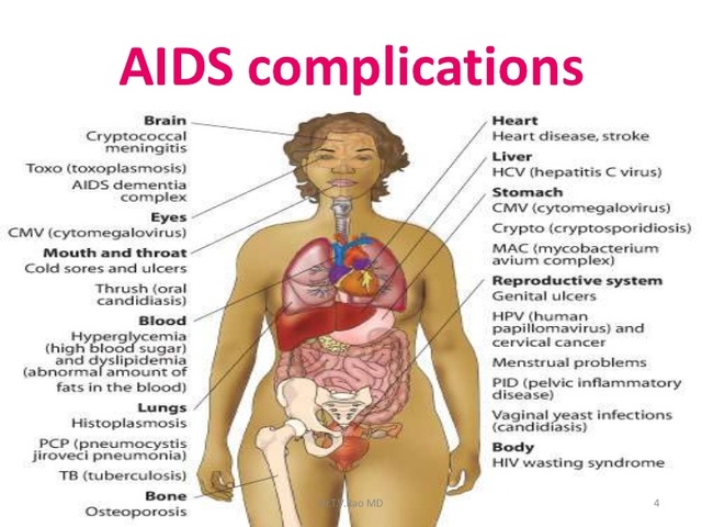 Jenny gets diagnosed with AIDS