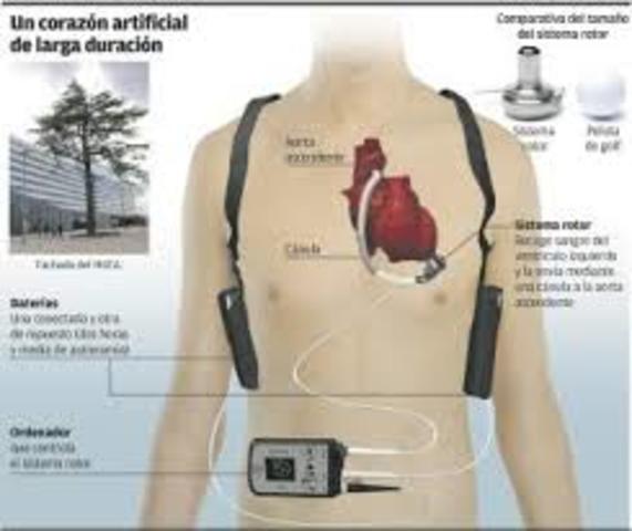CORAZON ARTIFICIAL(1953)