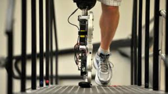First Mind controled bionic leg created and used