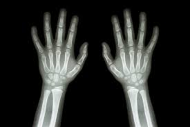 Descubrimiento de los rayos x