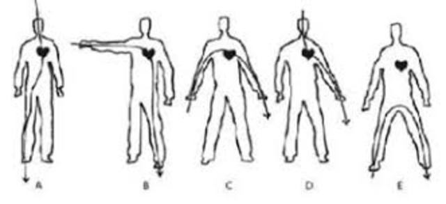 Experimento "corrente humana".