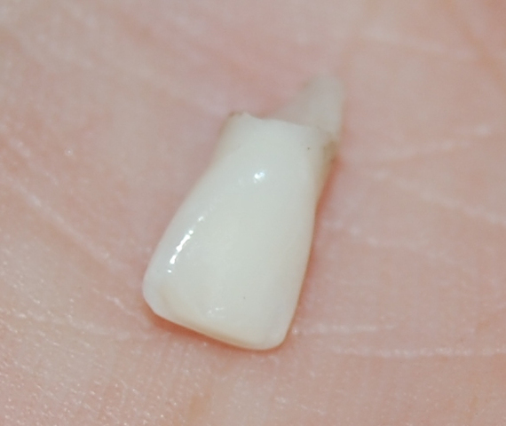 Se me cayo  mi primer diente