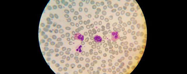 Zeiis fabrica unas lentes que mejoran el microscopio de Abbé