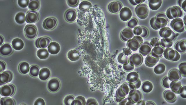 Lebedeff microscopio interferencia