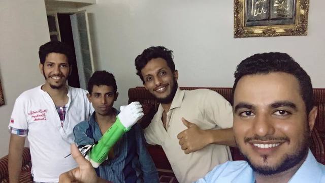 The First 3D Printed Limb in Yemen