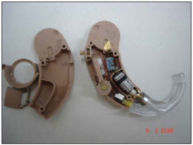 The First Successful Low-Cost Hearing Aid