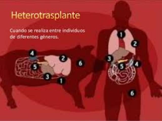 HETEROTRANSPLANTE