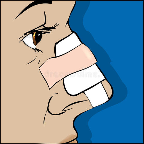 I FRACTURED MY NOSE