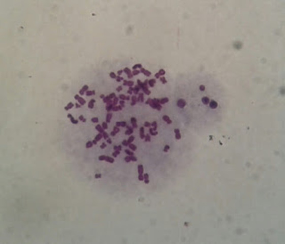 Walther Flemming descubre los cromosomas.