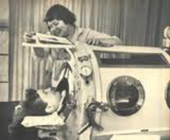 First Iron lung appeared