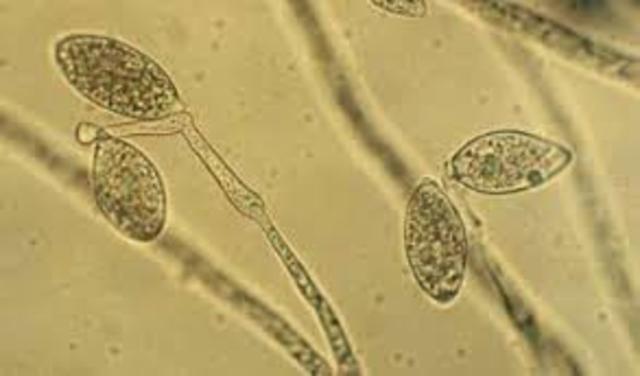 Tizón tardío de la papa